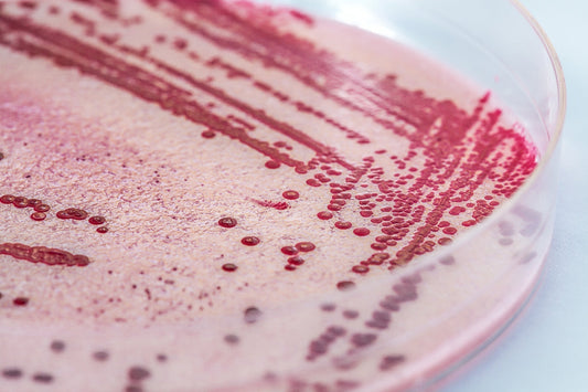 Listera monocytogenes growth on a plate