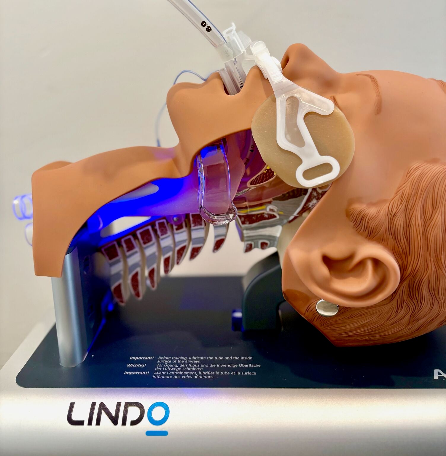 Lindo Tube: MWHI blue light prevents biofilm growth in endotracheal tube